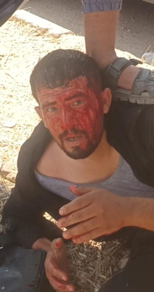 Attack on Young Kurdish Man from Displaced Serê Kaniyê Residents Upon His Return to the City in the Return Convoy